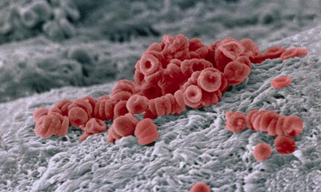 Red Blood Cells on Artery Wall