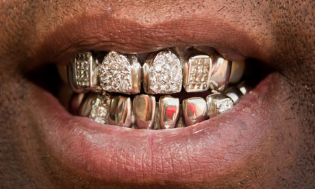 teeth dental grill grills grillz fronts dentist dentistry known expensive bottom
