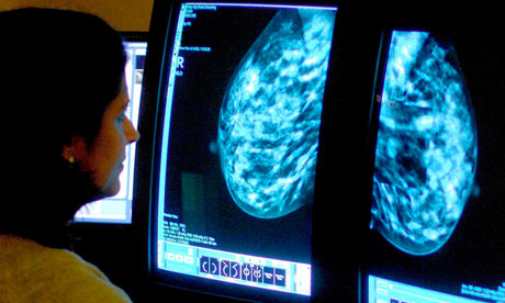 Breast screening