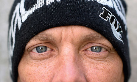 Experience: A head injury made me a musical prodigy