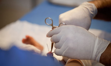 Baby circumcisions in U.S. hospitals decline over three decades