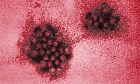 Electron micrograph of the Norwalk virus