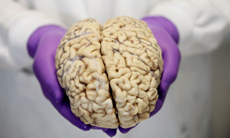 Un cerebro en el Banco de Cerebros