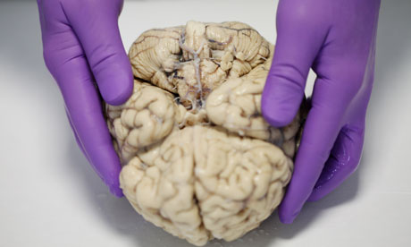 Steve Gentleman prepares to dissect a human brain.