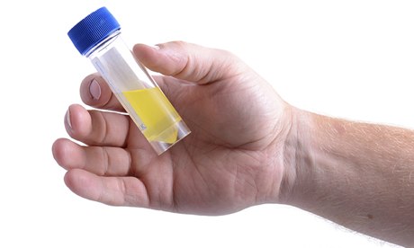 Urine sample