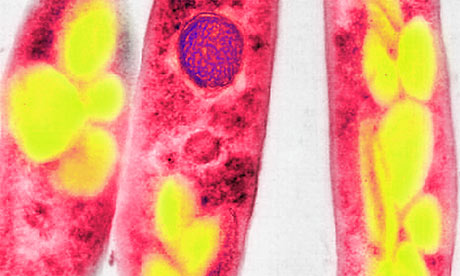anthrax bacteria