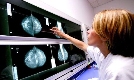 Breast cancer screening