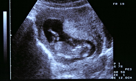 ultrasound image
