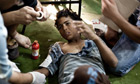 A wounded boy is treated as he lies on t