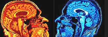 Scientist and artist brain scans