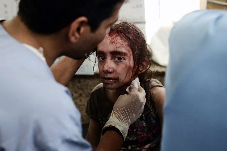 A Syrian girl receives treatment after she was wounded by regime force's helicopter