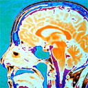 brain scan