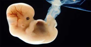 A human embryo