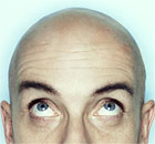 A bald man looking up. Photographer: Eirik Dreyer/Getty