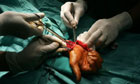Palestinian doctors conduct surgery on the hand of Omar Hamada,13, without anesthesia