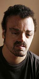 Christian Constantine, who has had more than 35 operations to rebuild his facial features