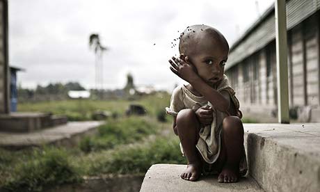 A child waits at a food centre in southern Ethiopia