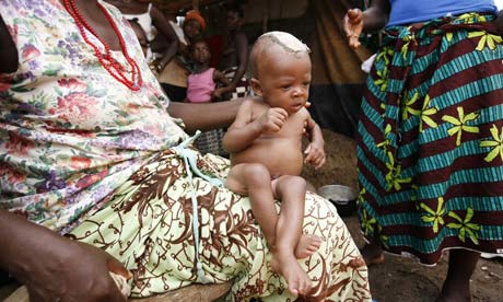 Osman, a six month old baby whose mother died during childbirth in Sierra Leone