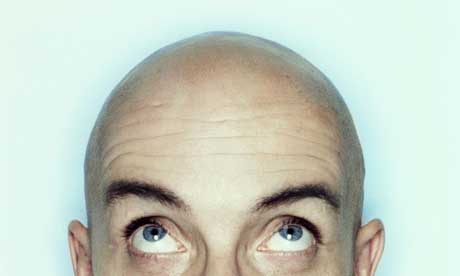 bald scalp