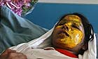 Afghan woman victim of acid attack