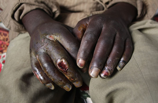 Gallery Tisdall year: A party worker for the opposition Movement for Democratic Change