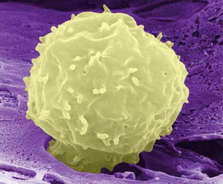 Stem cell emerging from bone marrow