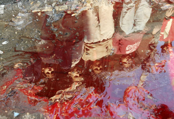 Gallery 24 hours in pictures : Palestinians are reflected in puddle of blood mixed with water in Gaza