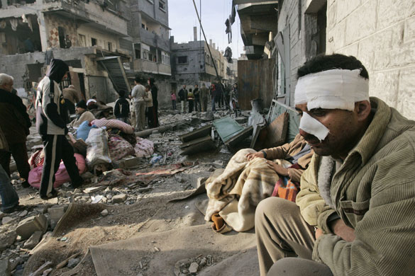 Gallery gaza: Injured palestinian man in gaza city