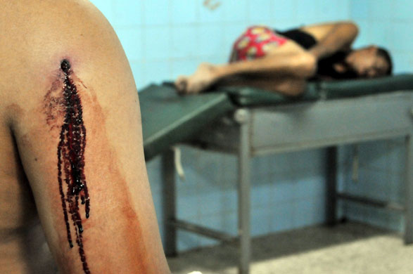 Gallery 24 hours in pictures: Hondurans injured in shooting