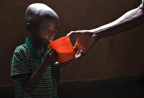 Gallery Laurent Nkunda  : Malnourished refugee in DR Congo