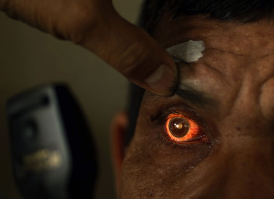 24 hours: A man has his eye examined by a paramedic in Indonesia