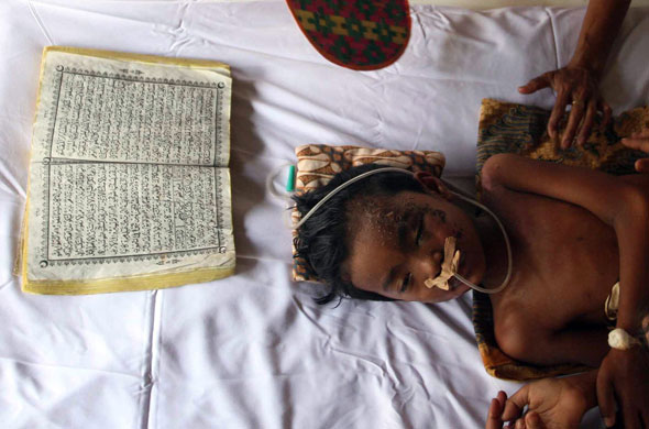 Sumatra earthquake: An Indonesian injured earthquake survivor sleeps at a hospital in Padang