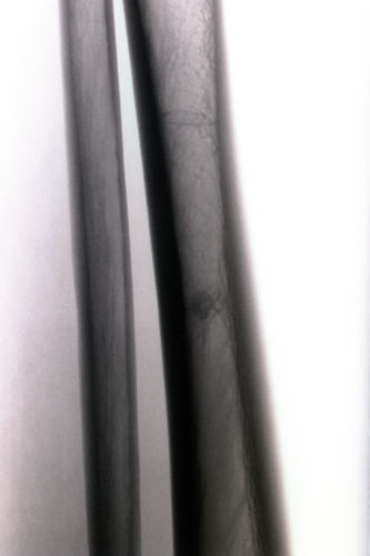 X-rays of torture: Torture x-rays