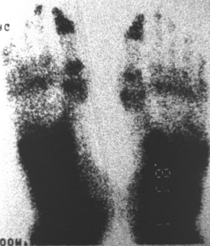 X-rays of torture: Torture x-rays