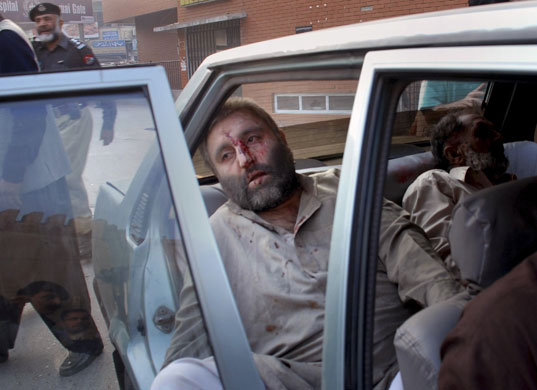 24 hours in pictures: Peshawar, Pakistan: An injured victim of a suicide car bombing
