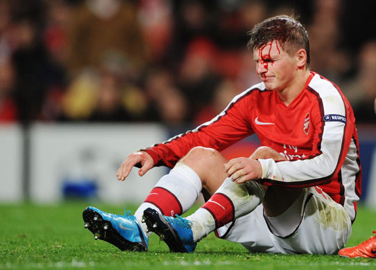 British Teams 2: A bloodied Andrei Arshavin sits on pitch following a clash of heads