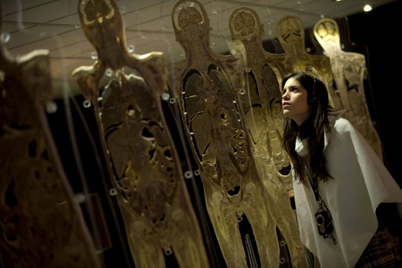24 Hours in Pictures: A visitor looks at transversal cuts of a human body on display