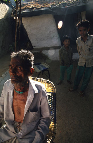 Bhopal 25th anniversary: The Union Carbide Corporation poisonous Gas Disaster