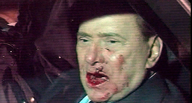 Berlusconi bleeds : Berlusconi bleeds after being punched in Milan 
