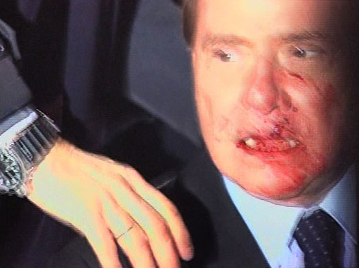 berlusconi attack: Silvio Berlusconi a fter being struck in the face