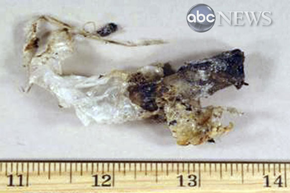 Umar Farouk Abdulmutallab: The syringe detonator is seen in government photos 