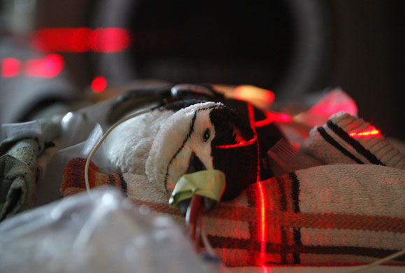 24 hours: Blue Ash, Ohio, US: Tica, a male Chinstrap Penguin has cancer treatment 