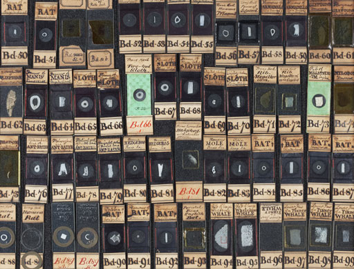 Eyewitness: Specimen slides at the Hunterian museum, Royal College of Surgeons