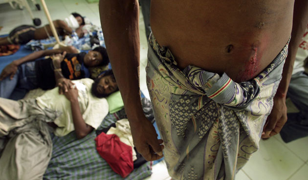 Gallery Rohingya refugees: Rohingya boat people receive medical treatment