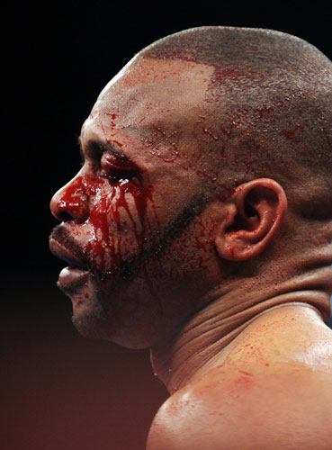 Gallery Calzaghe Retires: A bloodied Roy Jones Jr
