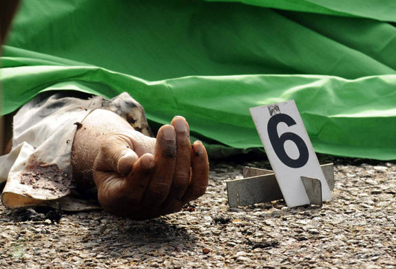 10 March 2009: Akuressa, Sri Lanka: The hand of a victim of a bomb blast