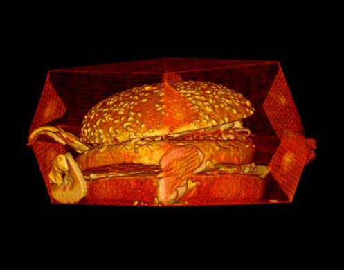 Culture CT scan : Satre Stuelke Big Mac