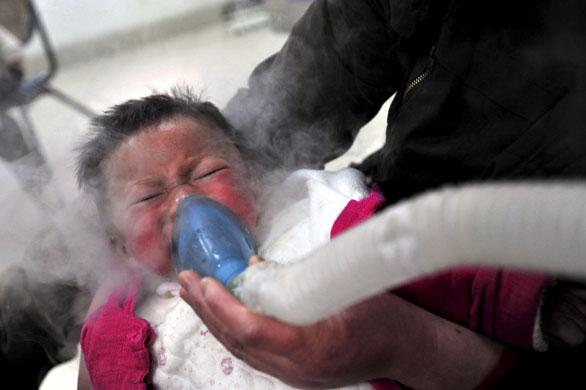 27 March 2009: Wuhan, China: A child diagnosed with hand, foot and mouth disease