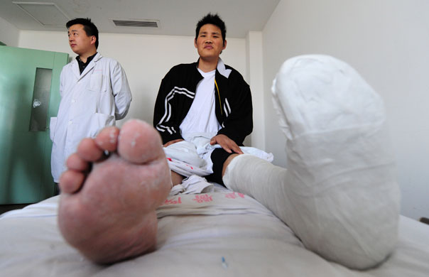 24 hours in pictures: 2.46 meter tall Zhao Liang, 27, recuperates from foot surgery in China