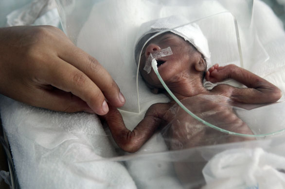 27 April 2009: Trujillo, Peru: A seven-day-old premature baby girl